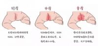 婴幼儿夏季“防痱“指南