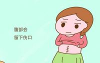 剖腹产对女人的好处有哪些 剖腹产要注意哪些事项