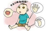 手足口病什么季节多见 手足口病高发期怎么预防传染