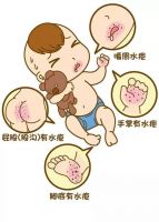 口足手病前三天的症状  口足手病的传播途径有哪些