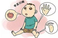 手足口病怎么确诊 口足手病如何传播