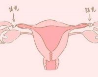 结扎和不结扎的女人有何区别 结扎对女性最大的危害是哪些