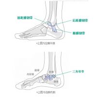 希格玛SIGMAX护踝：警惕习惯性崴脚
