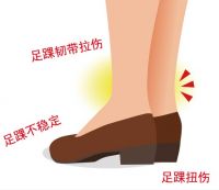 希格玛SIGMAX护踝：警惕习惯性崴脚