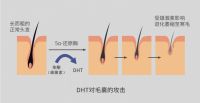 射频健发梳提醒你科学养护头发