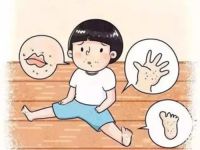 得了手足口病应该注意什么 得了手足口病能洗澡吗