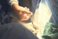 女人结扎了12年了还能接吗 结扎十二年还会怀孕吗